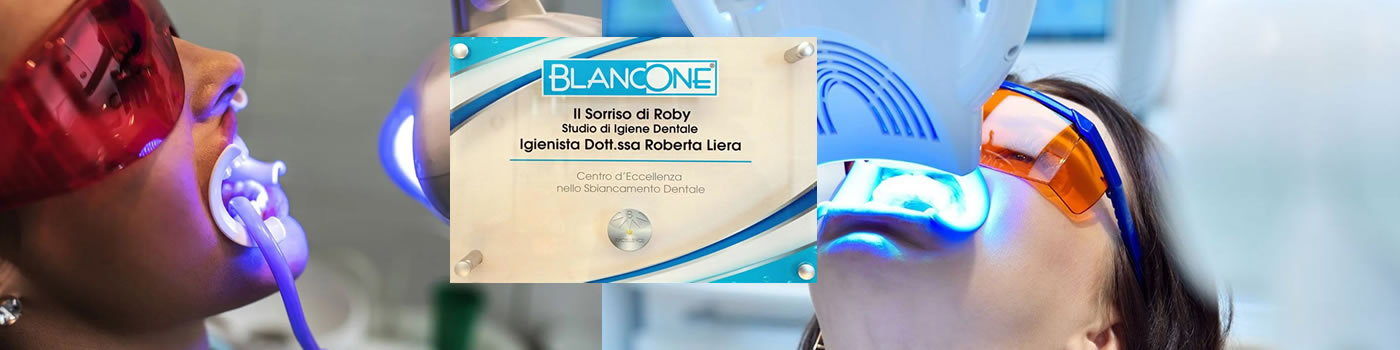 Sbiancamento dentale a Novara | Studio Odontoiatrico Il Sorriso di Roby