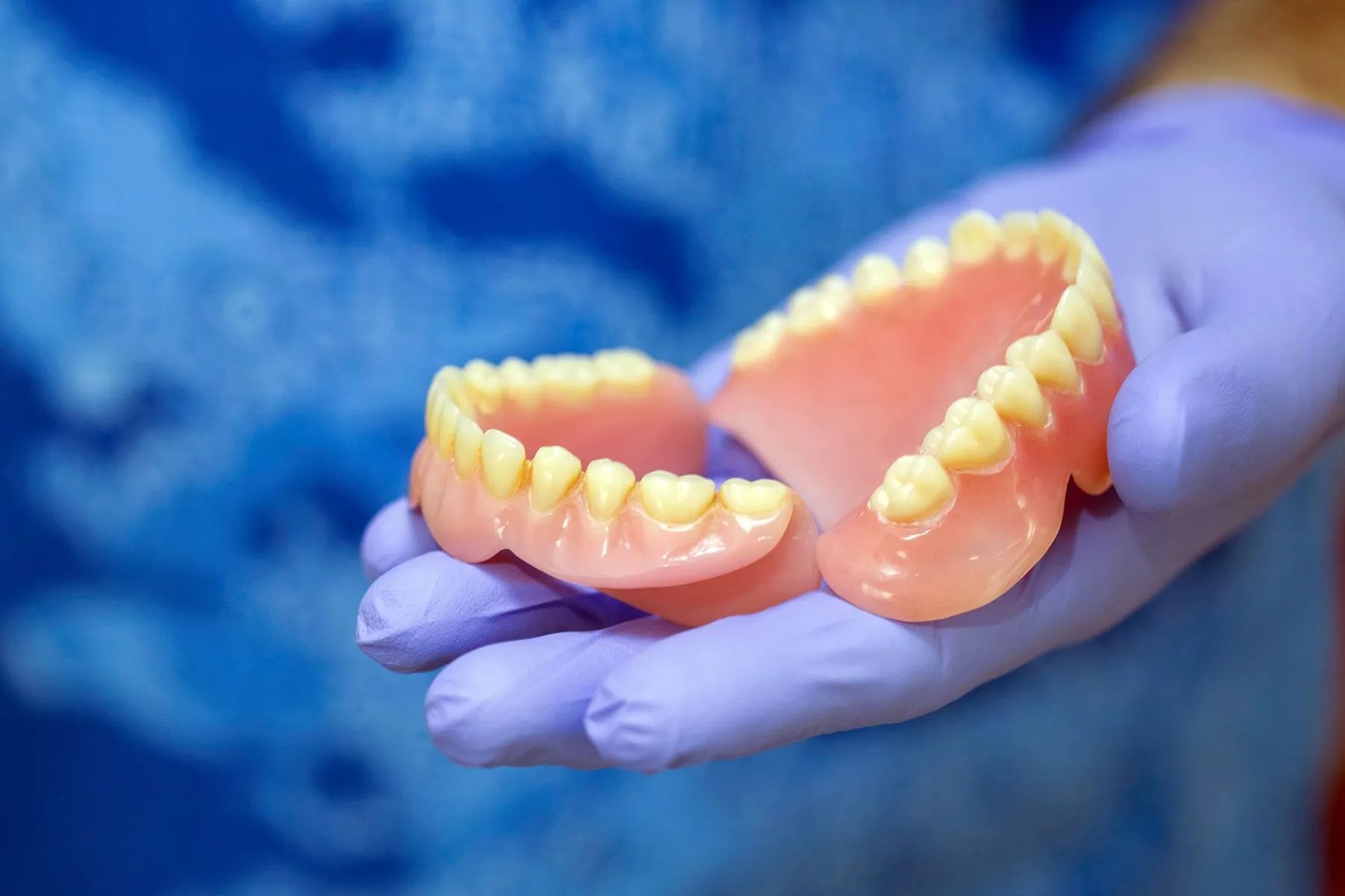 implantologia protesica